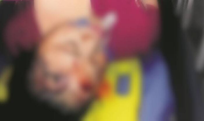 LE CAE BALA EN LA CABEZA A RESIDENTE DE LAREDO