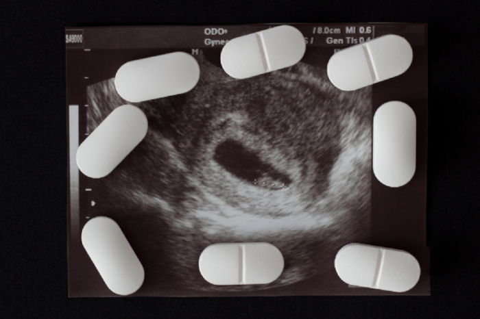 Estados Unidos vendería pastillas para abortar en farmacias