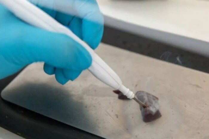 Así funciona el iKnife, el bisturí inteligente que "huele" el cáncer: puede detectarlo en segundos