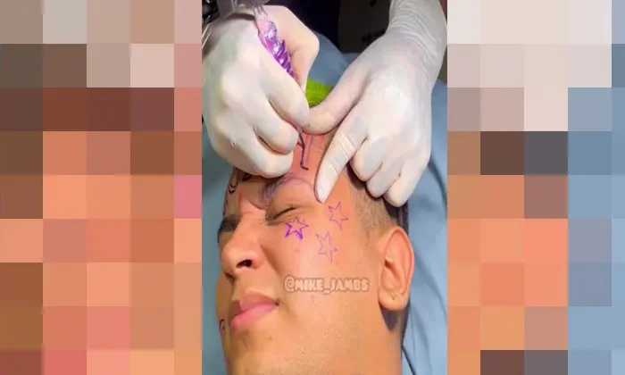 Se tatúa Messi en la frente y ahora busca quién se lo borre