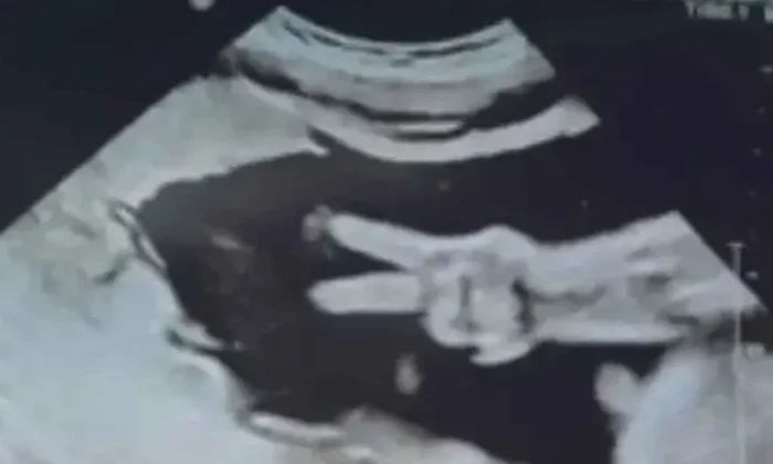 Bebé sorprende a sus padres al hacer la señal de amor y paz en ecografía