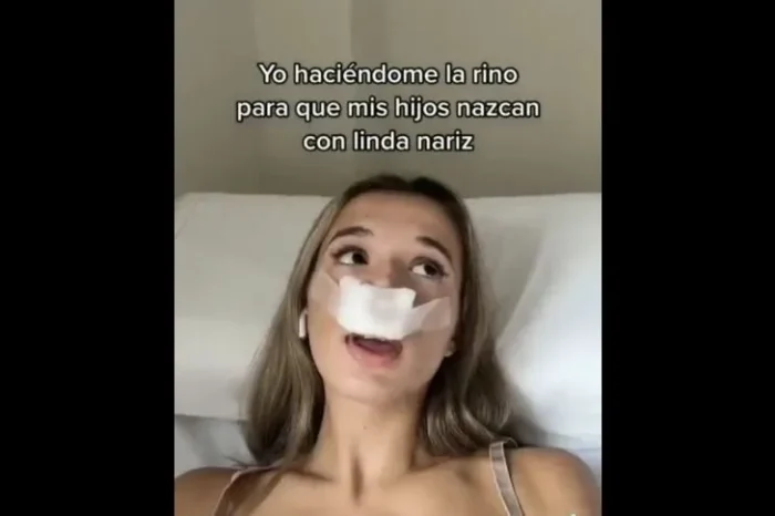 ¡Viral! Influencer se hace rinoplastia para que sus hijos nazcan con nariz linda