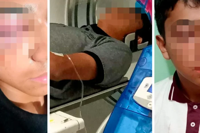 Por caso de bullying, joven en riesgo de perder la vista