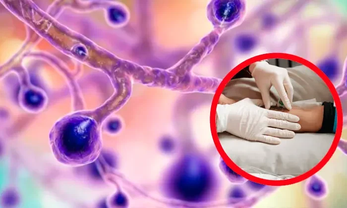 Alerta por el brote de hongos más grande en la historia