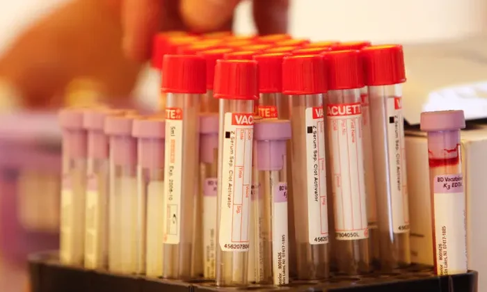 Registran oleada de casos de SIDA