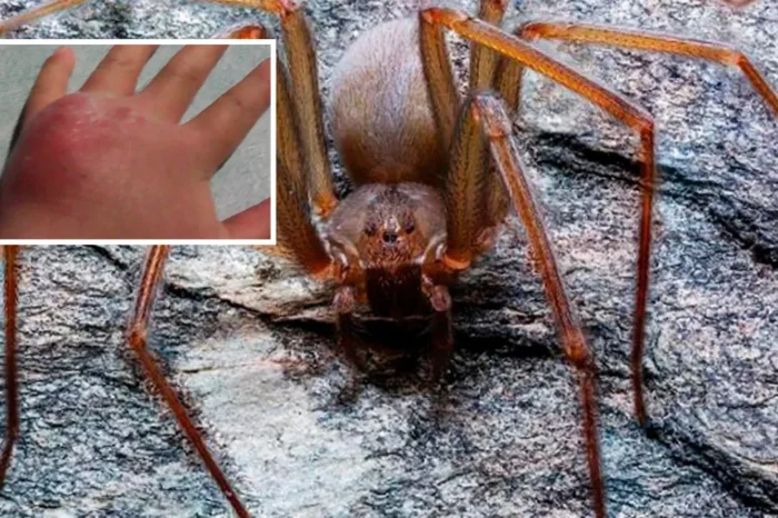 Niño es picado por araña violinista, pero clínica pedía $30 mil por antídoto