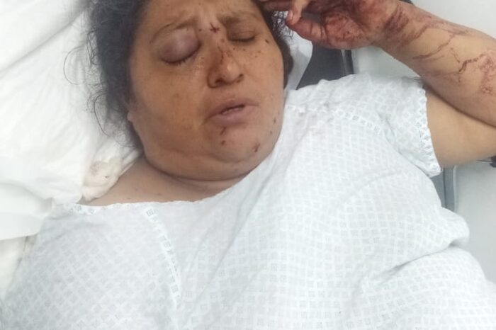 Mujer pierde el ojo por disparo; responsabiliza a militares