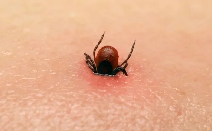 Muere niña de dos años tras ser mordida por garrapata en Torreón