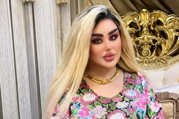 Joven se realizó más de 40 cirugías estéticas para ser la Barbie Iraquí