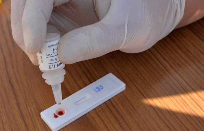 Atienden a 4 mil pacientes por VIH