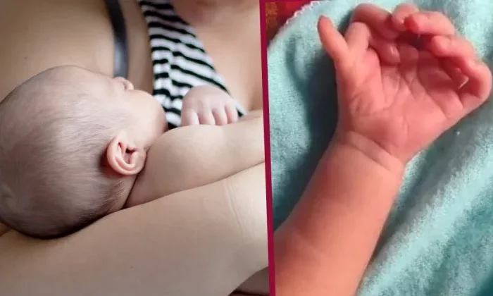 Bebé nace con 26 dedos en manos y pies; lo consideran la reencarnación de una diosa