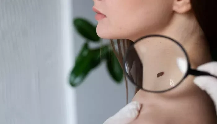 Mujer diagnosticada cáncer terminal se sometió a quimioterapias y descubrió que nunca estuvo enferma