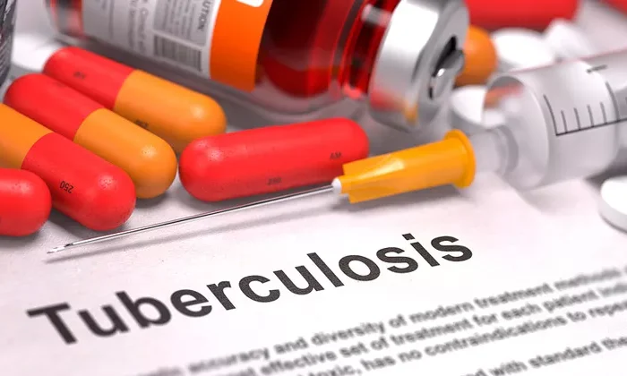 Asecha la tuberculosis a Tamaulipas