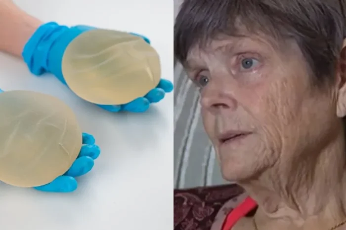 Cirujanos le aumentan el busto a abuelita en contra de su voluntad en Tijuana