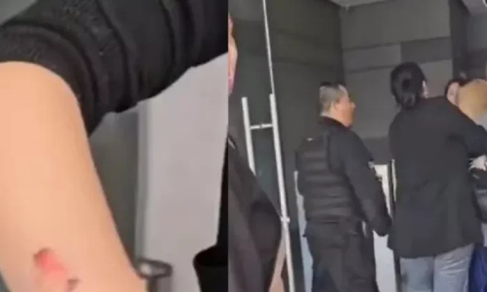 Mujer se niega a pagar sus uñas y ataca a mordidas a trabajadoras de spa