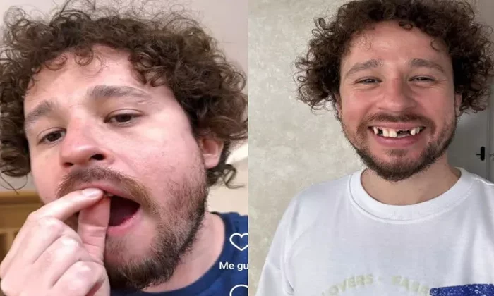 Luisito Comunica revela por qué se le cayeron los dientes