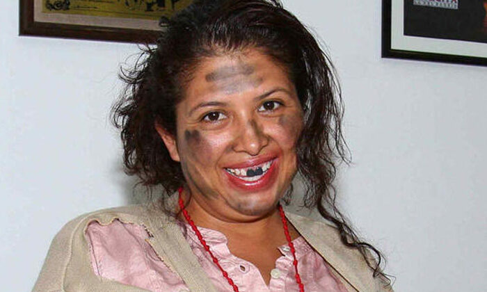 ‘La Chupitos’ confiesa que tiene extraña enfermedad que no le permite llorar