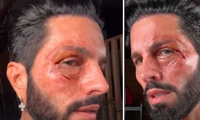 ¿Por qué Poncho de Nigris acusó a Adal Ramones y a su mamá de haberle dado una golpiza?