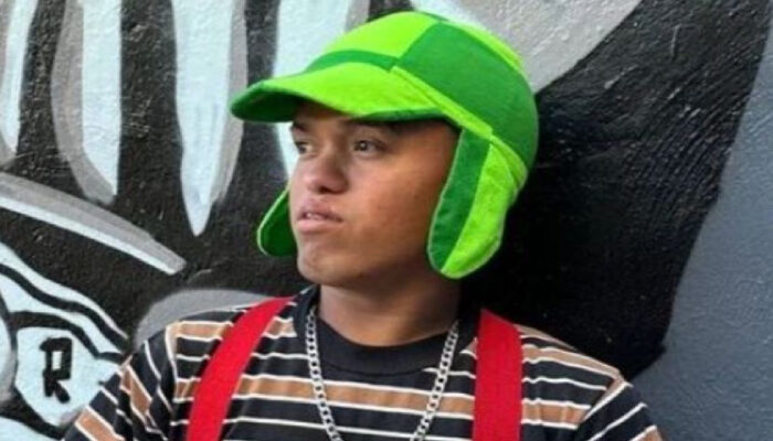 Reportan que un perro mordió a Medio Metro y se encuentra grave