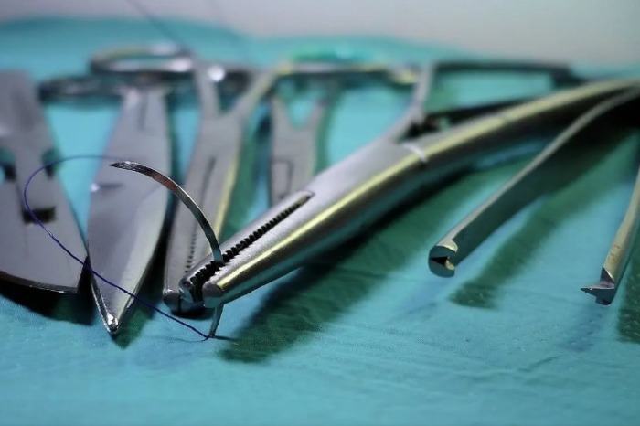 Niño fue operado de una fractura en su pierna, horas después su madre lo recibió sin vida