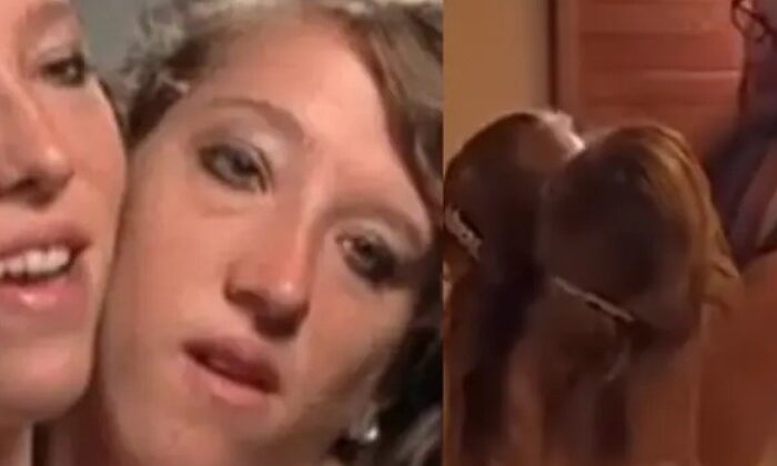 Hombre se casa en secreto con siamesas famosas