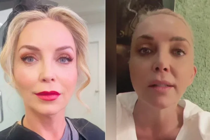 Laura Flores se somete a tratamiento estético y sufre un microinfarto cerebral