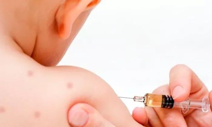 Alerta la OMS por aumento en casos de sarampión