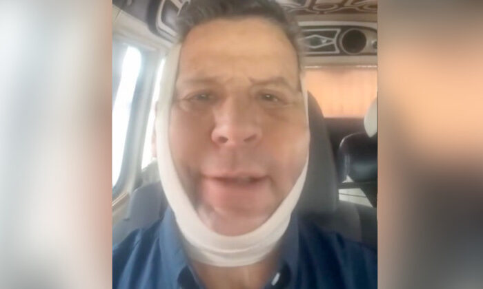 Alfredo Adame reaparece con la cara vendada e hinchada