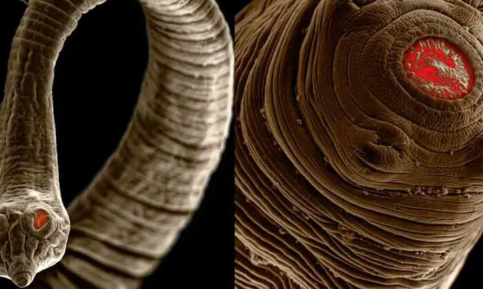 Científicos muestran espeluznantes imágenes ampliadas de parásitos intestinales