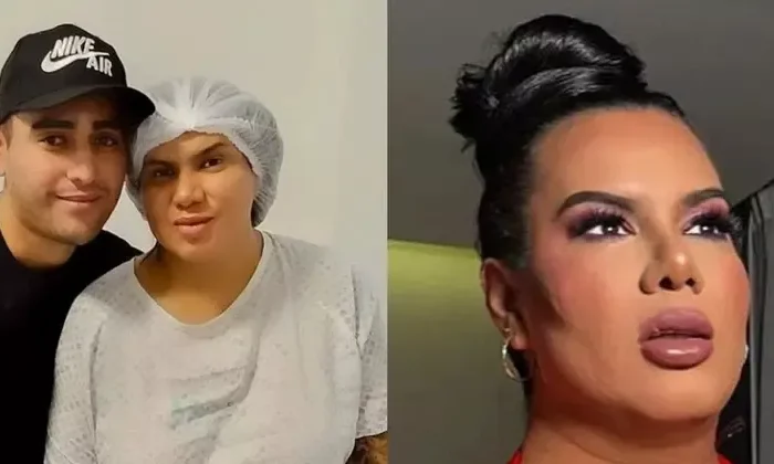 Kimberly ‘la más preciosa’ fue operada de emergencia