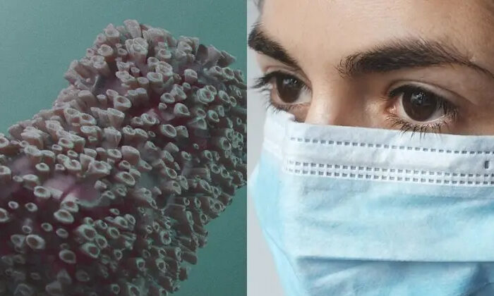 Te decimos qué hacer y cuáles son los cuidados si tienes viruela del mono