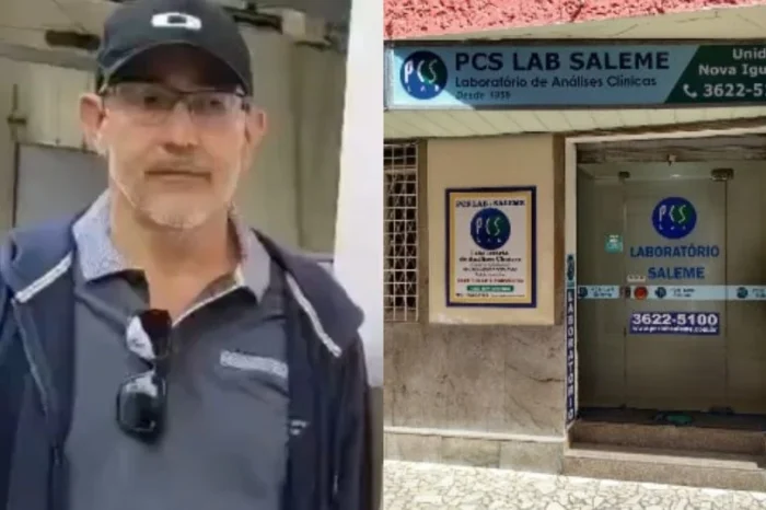 Seis pacientes dan positivo a VIH por trasplante de órganos infectados en Brasil