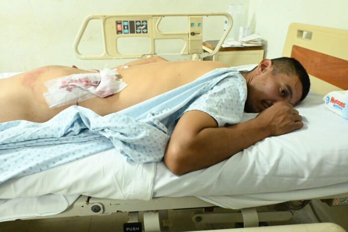Ciudadanía en riesgo ante agresiones militares: Hombre inocente herido en Nuevo Laredo