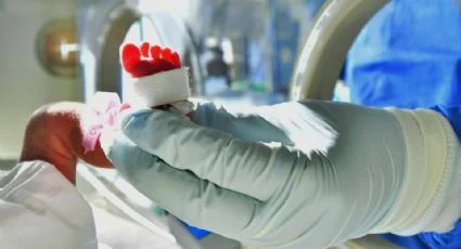 México confirma al menos 20 niños afectados por bacteria Klebsiella oxytoca