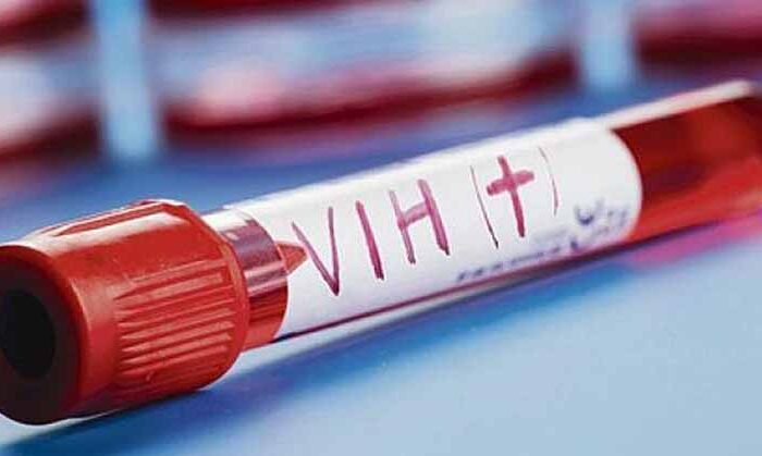 Un 15% de población ignora que tiene SIDA