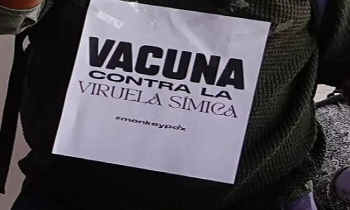 México suma 116 casos de Viruela del mono