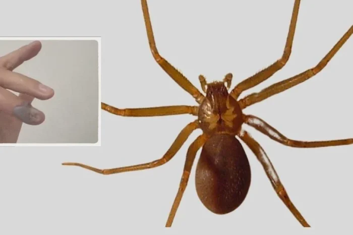 Joven es picado por una araña violinista; IMSS le niega atención médica en Puebla