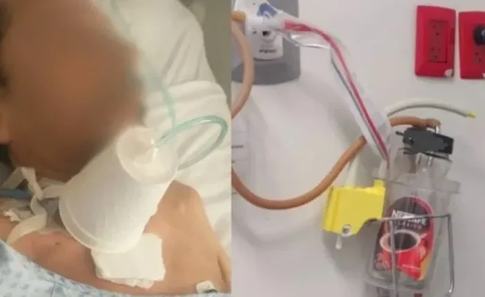 Hospital de Durango atendió a pacientes con frascos para café y vasos de unicel