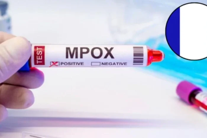 Detectan primer contagio de mpox 1b en Francia