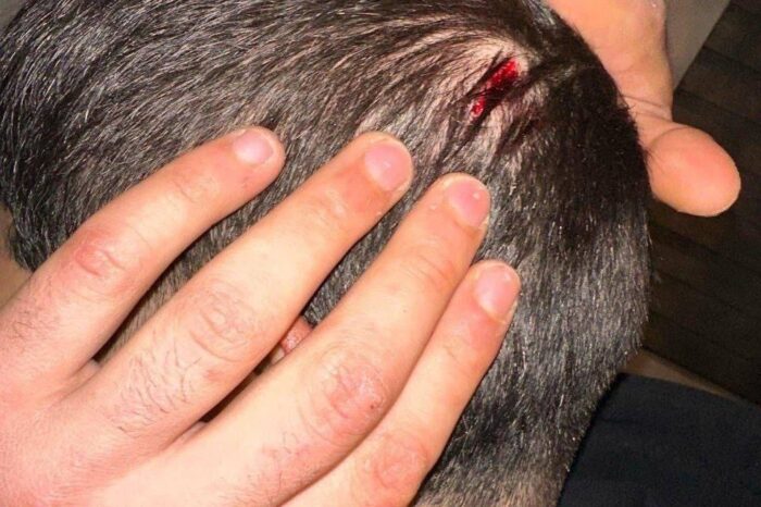 Militares agreden a jóvenes en la colonia Buenos Aires y roban sus pertenencias