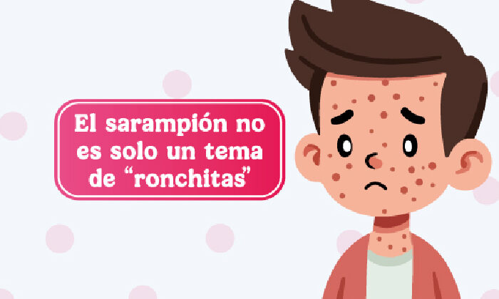 Sarampión supera los 18 mil casos en México; suman 41 defunciones