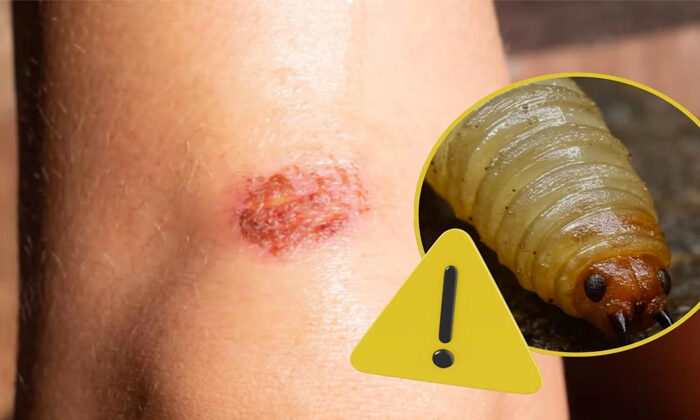 ¡Alerta en Tamaulipas! Detectan otro caso de miasis por gusano barrenador