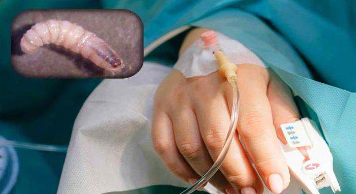 Muere paciente con gusano barrenador en Tamaulipas