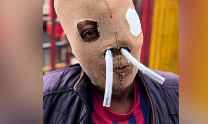 Tras 26 años de dolor y más de 80 cirugías, mujer pide la eutanasia